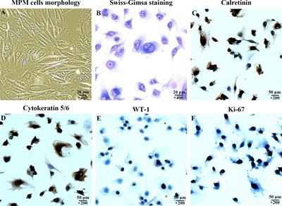 Apatinib Mesylate Inhibits the Proliferation and Metastasis of Epithelioid Malignant Peritoneal Mesothelioma In Vitro and In Vivo